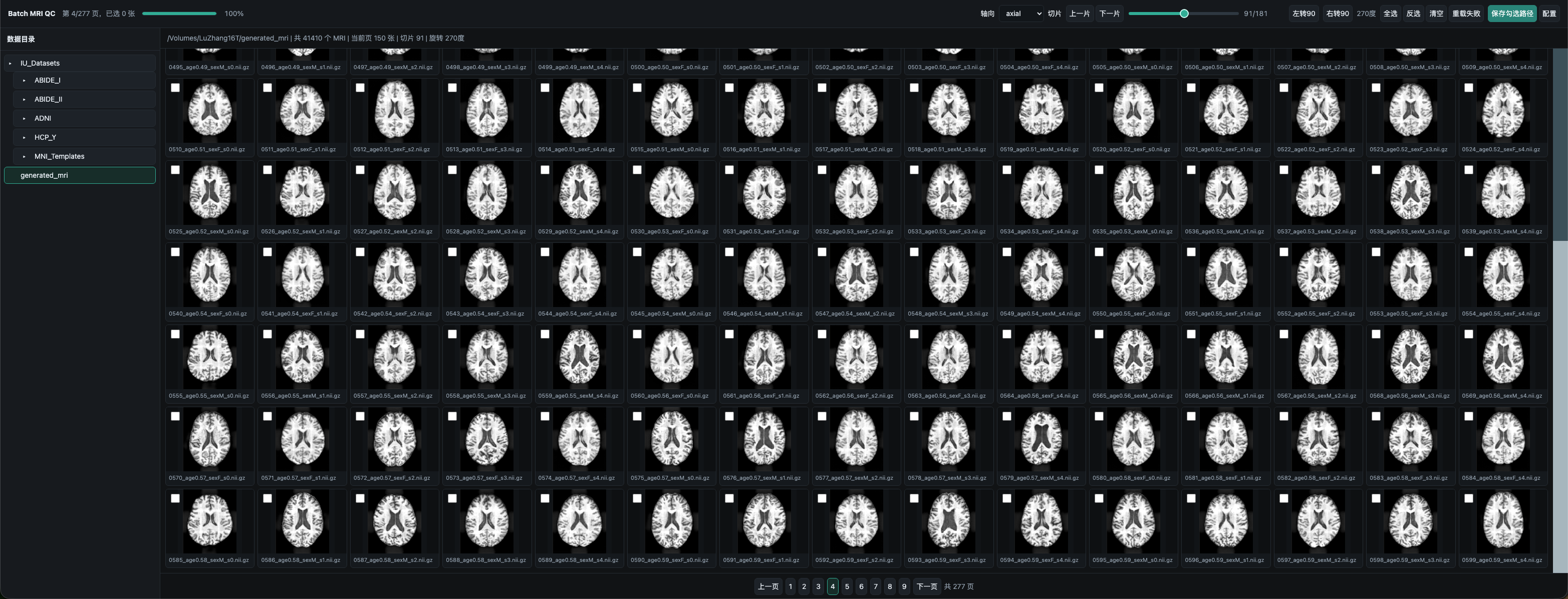 Batch MRI quality-control project demo